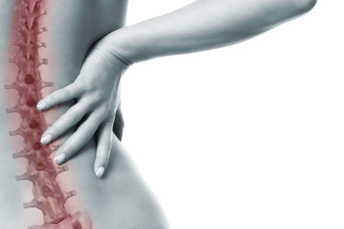 Escoliose: O Que É, Vantagens e Benefícios da Cirurgia