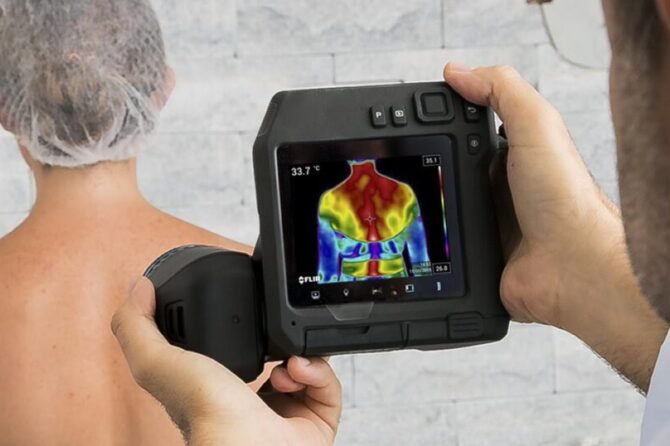 Síndrome Miofascial e Termografia: Identificando a Dor de Forma Inovadora