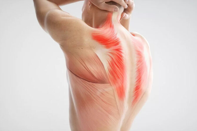 Sarcopenia, Coluna Vertebral e Articulações: Como Prevenir e Tratar