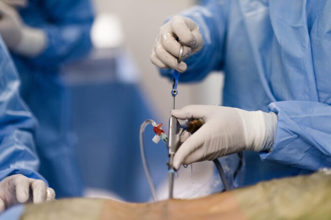 Cirurgia Minimamente Invasiva da Coluna: Menos Dor, Recuperação Mais Rápida e Resultados Surpreendentes